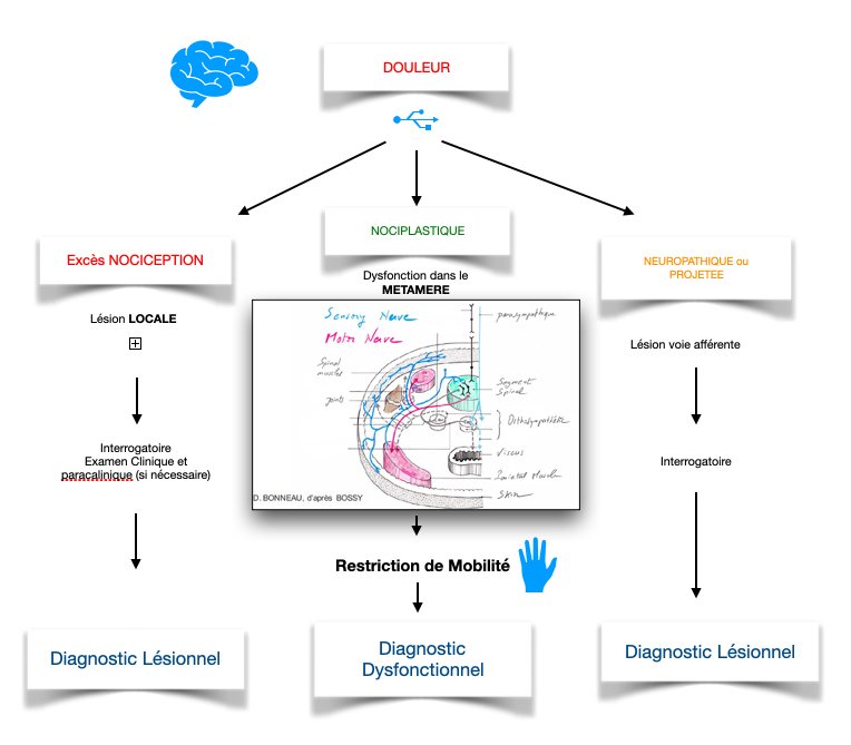Diagramme douleur IASP.png
